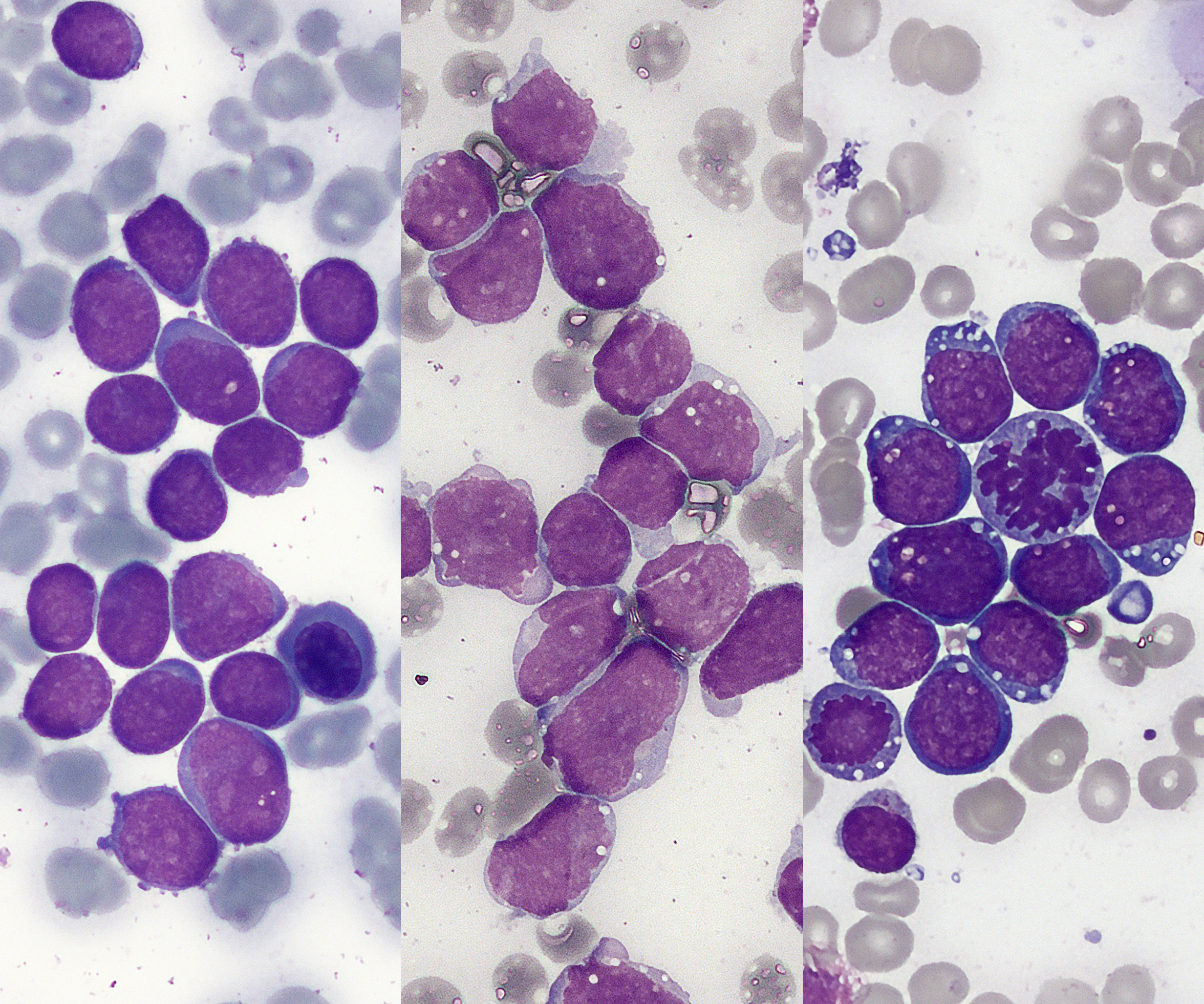 ALL cells